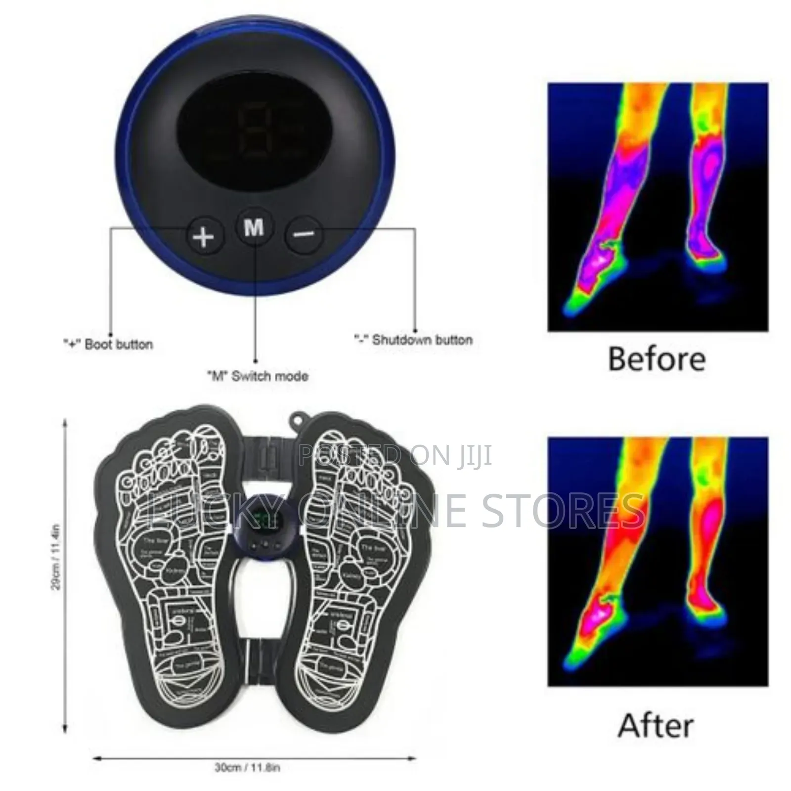 Ems Acupoints Foot Massager