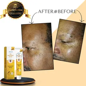 Bee Venom Wart Cream Remove, Gentle Skincare Skin