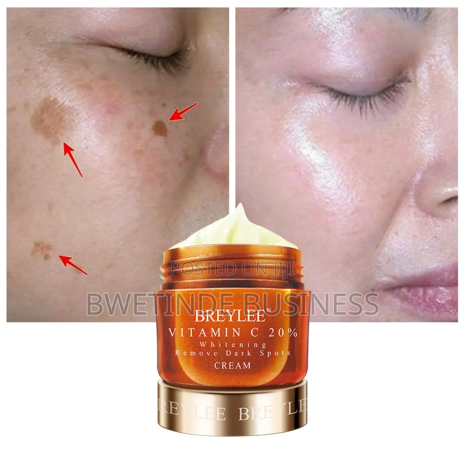Vitamin C 20% Whitening Cream