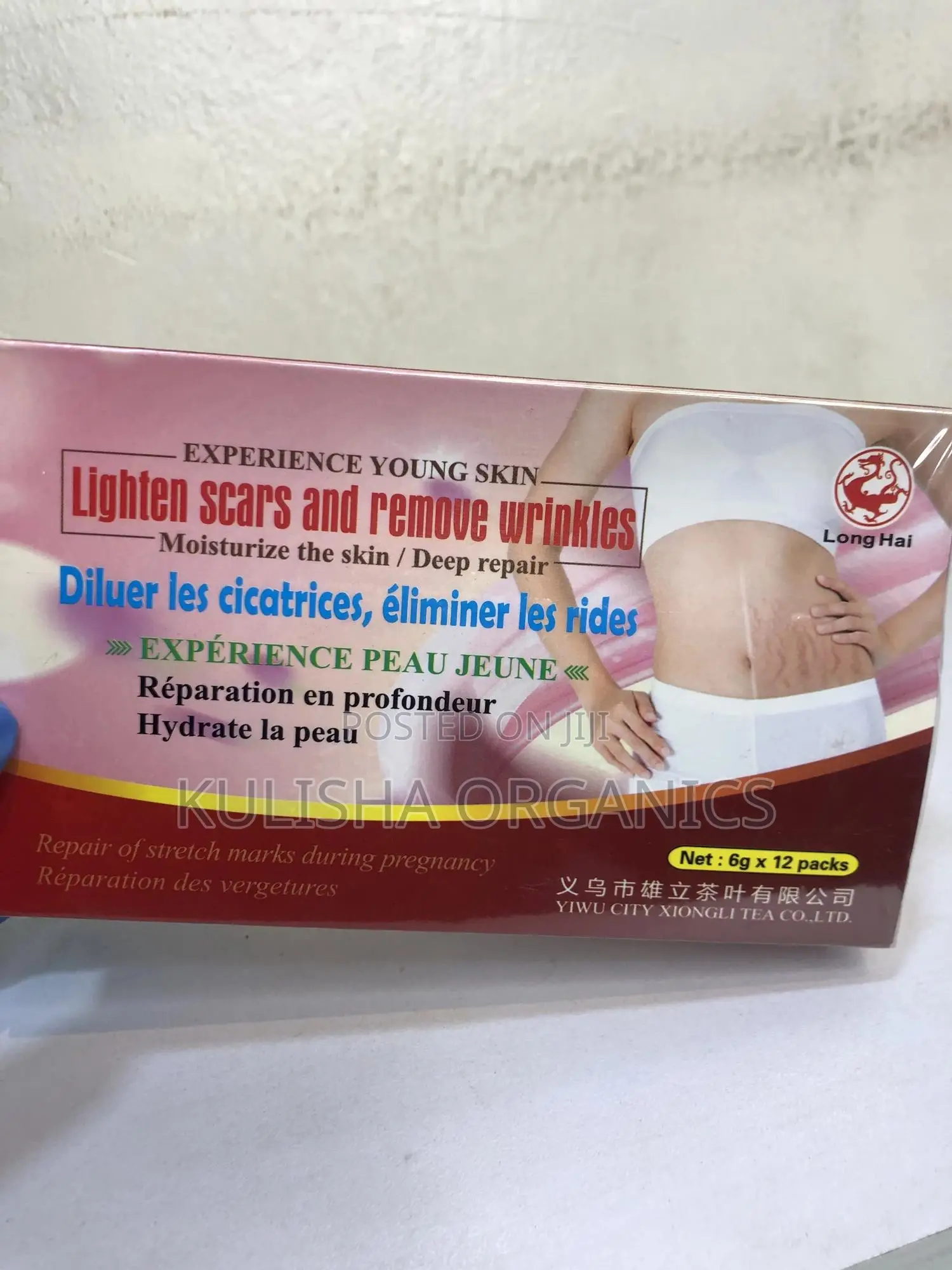 Stretch Marks Removal Cream – 100% Natural Treatment