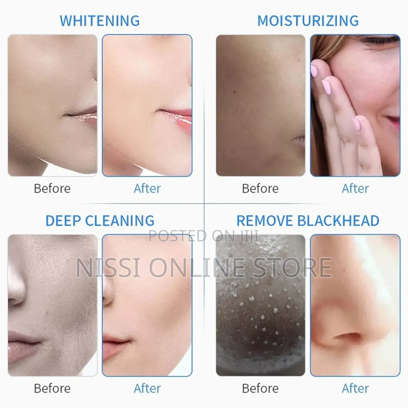 6 in 1 Hydro Dermabrasion Facial Machine