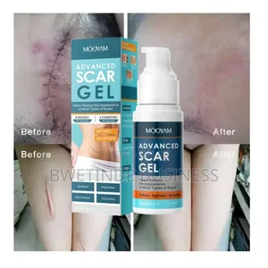 Photo - Advanced Scar Gel