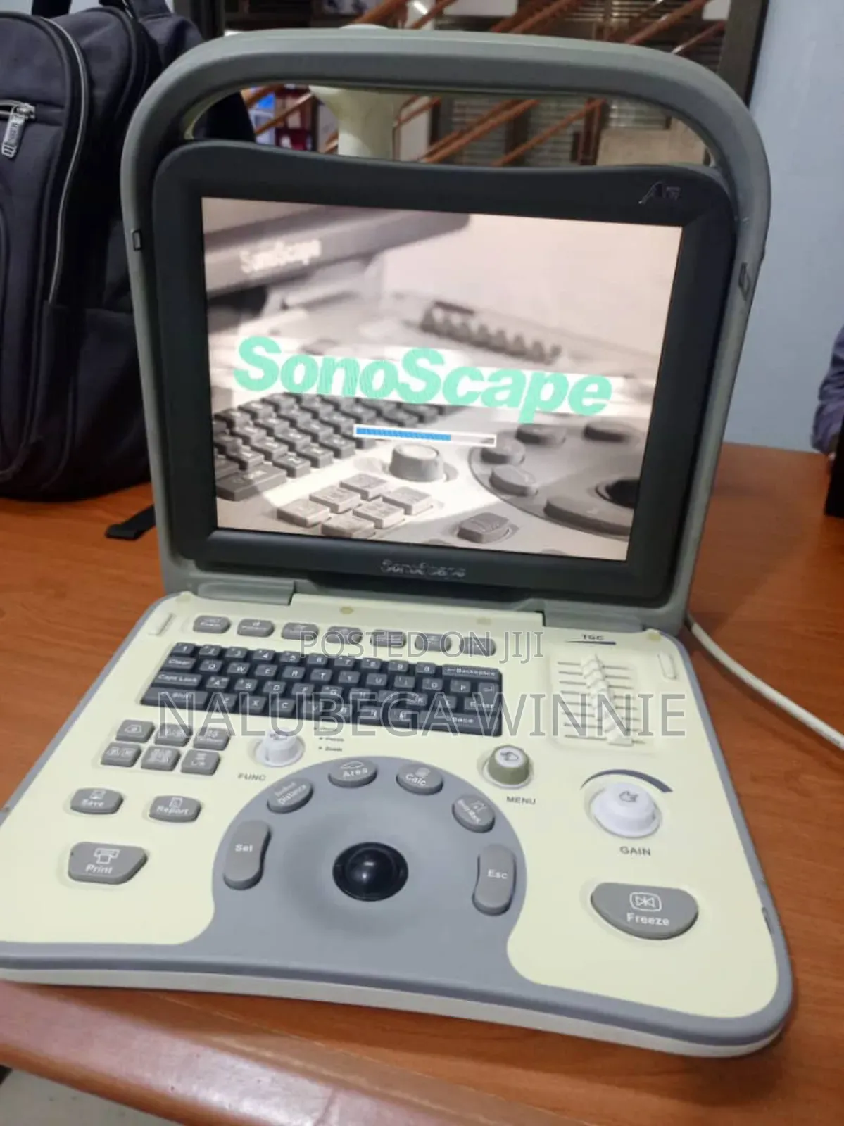 Sonoscope Ultrasound Scan
