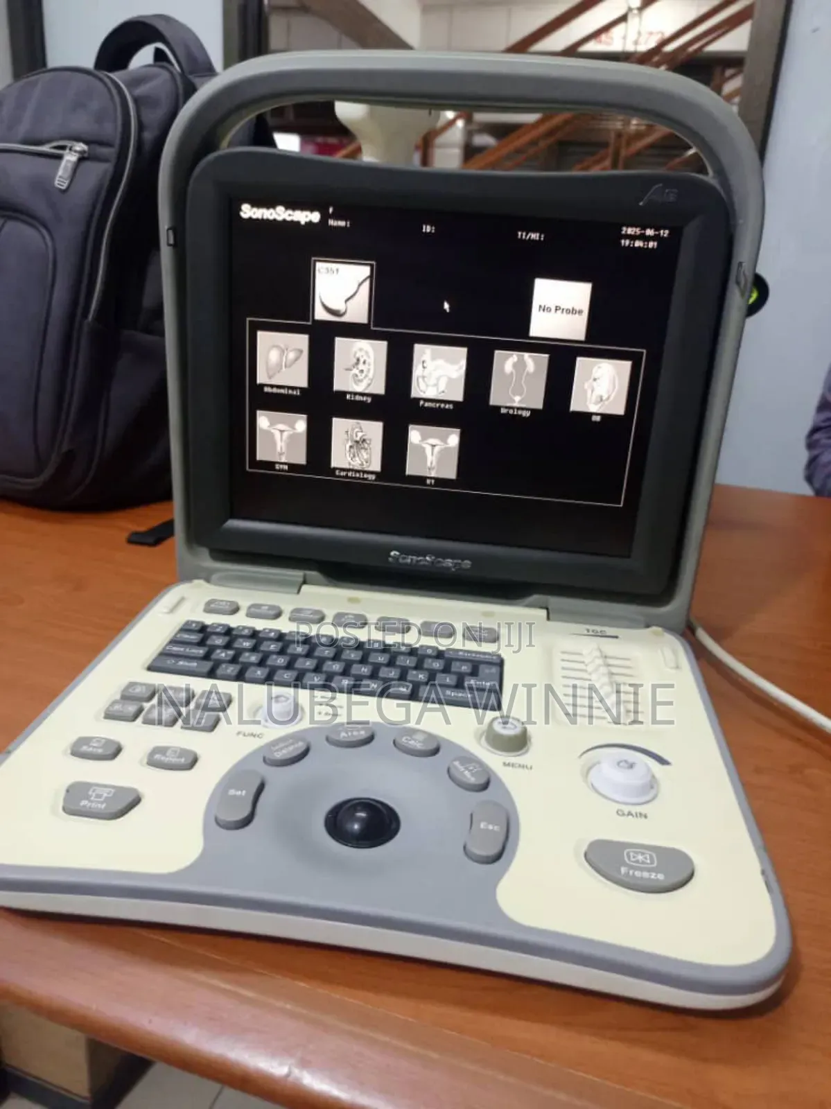 Sonoscope Ultrasound Scan