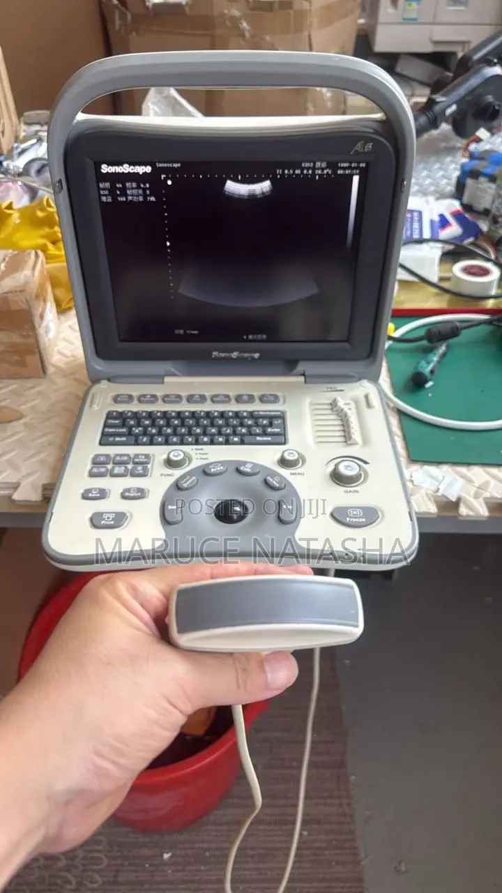 A5 Sonoscape Ultrasound Scan Machine