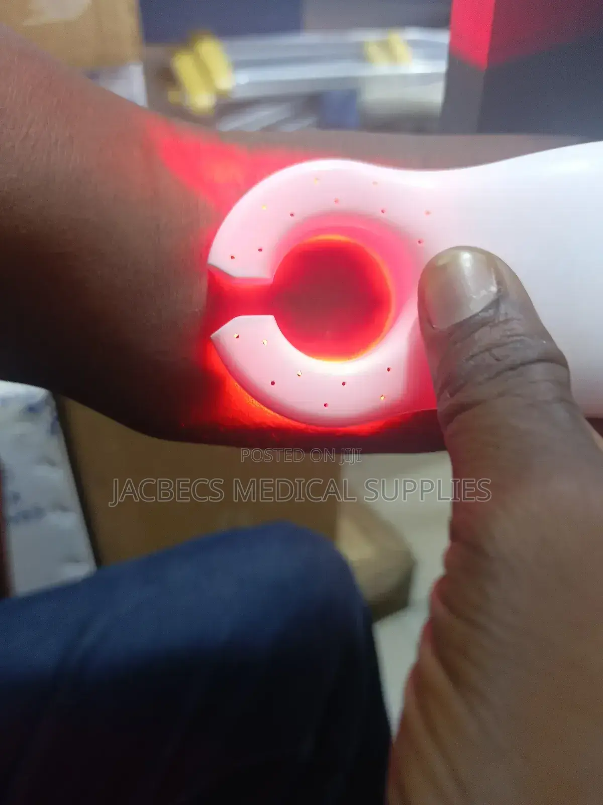 Vein Locator