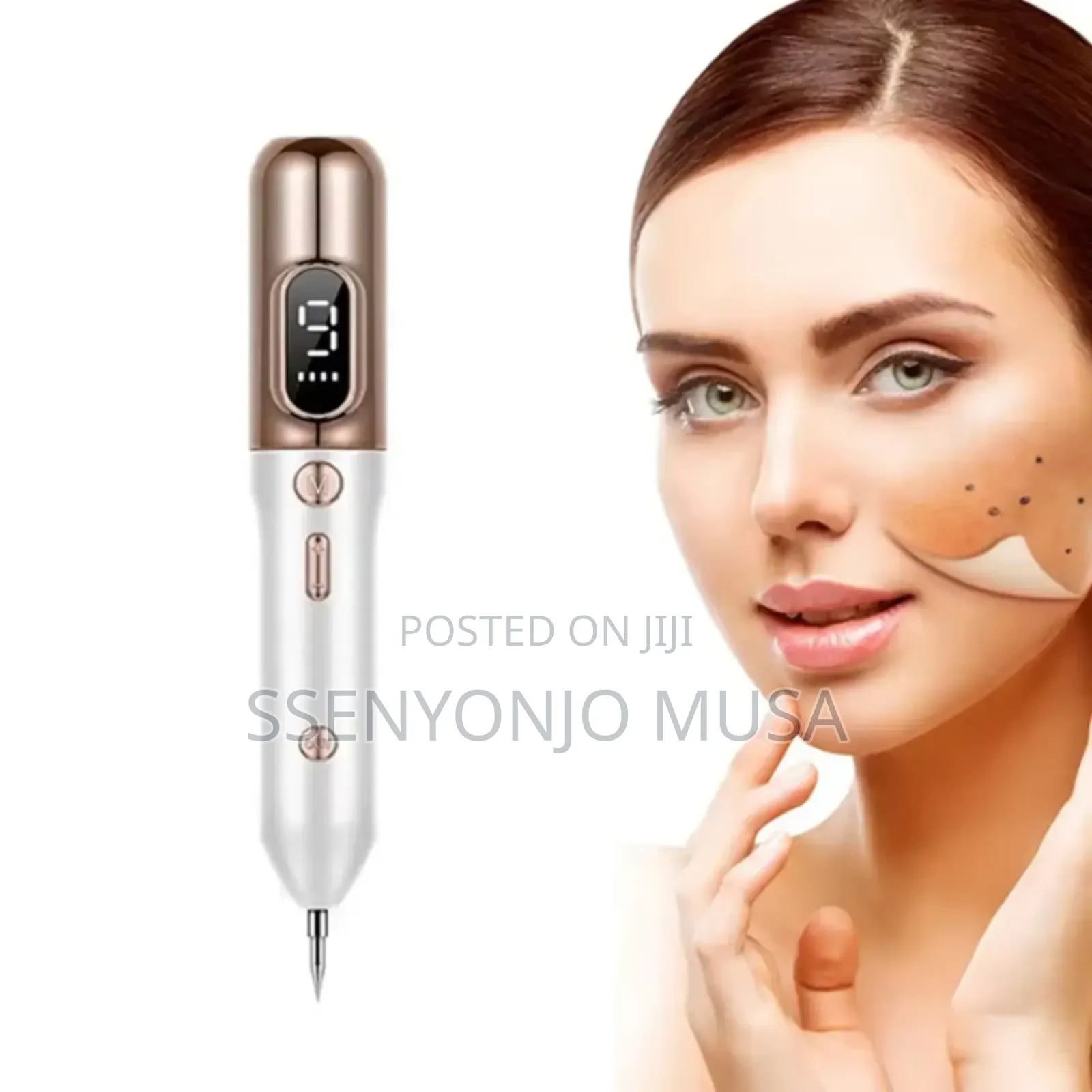 Skin Tag Remover Kit - Effective Mole Wart Removal