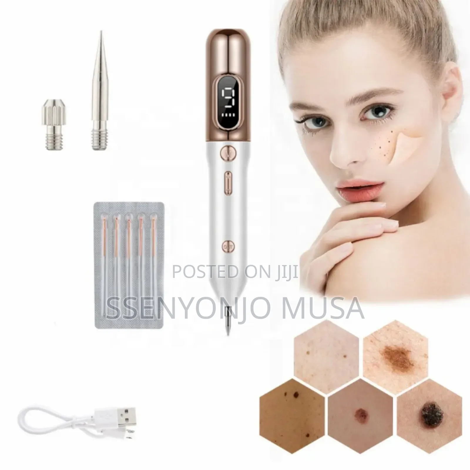 Skin Tag Remover Kit - Effective Mole Wart Removal