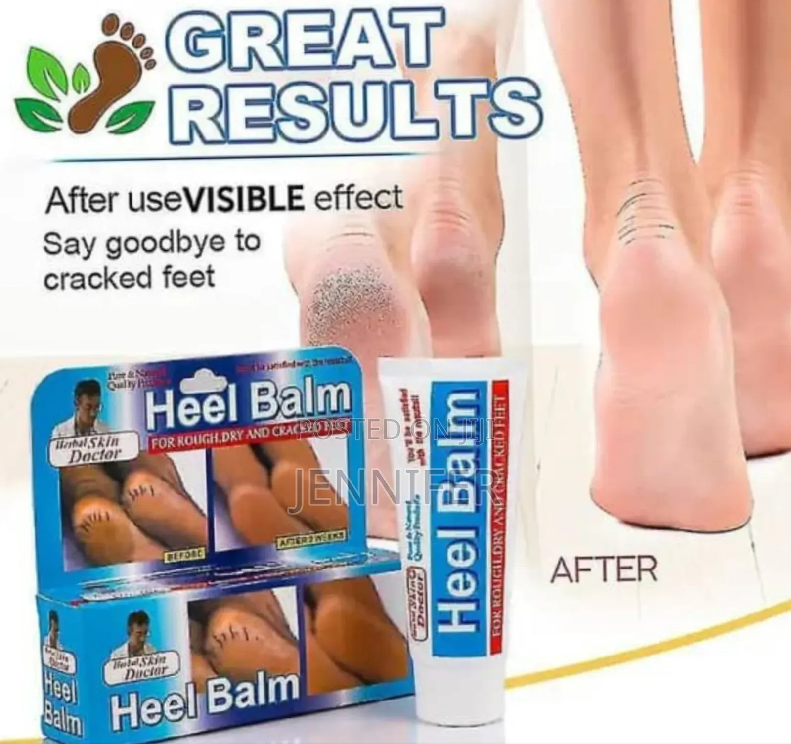 Skin Doctor Herbal Heel Balm