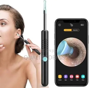 Smart Ear Wax Remover