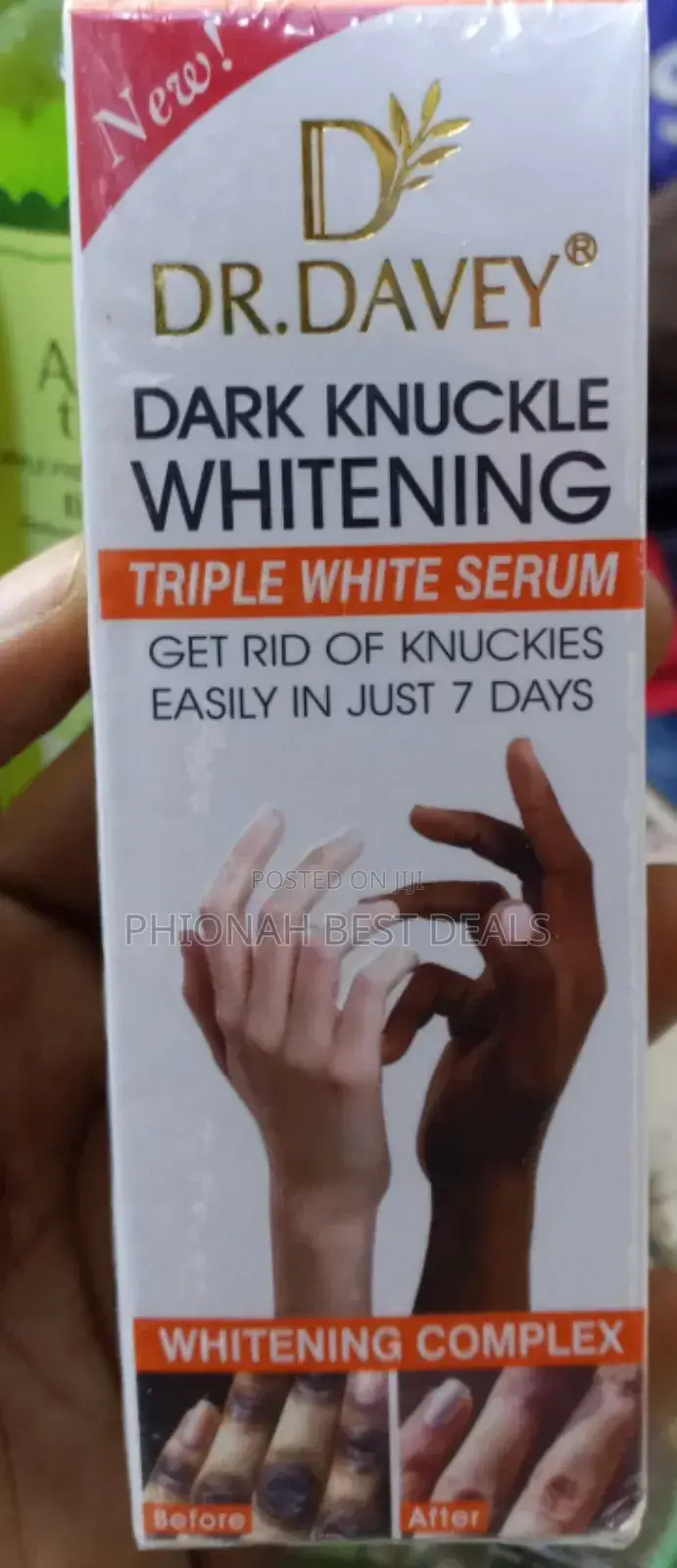Dr. Davey Dark Knuckle Whitening