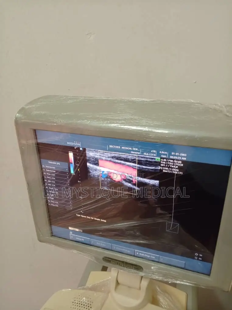 Sumsang Medson High End Ultrasound Scan With Three Probes