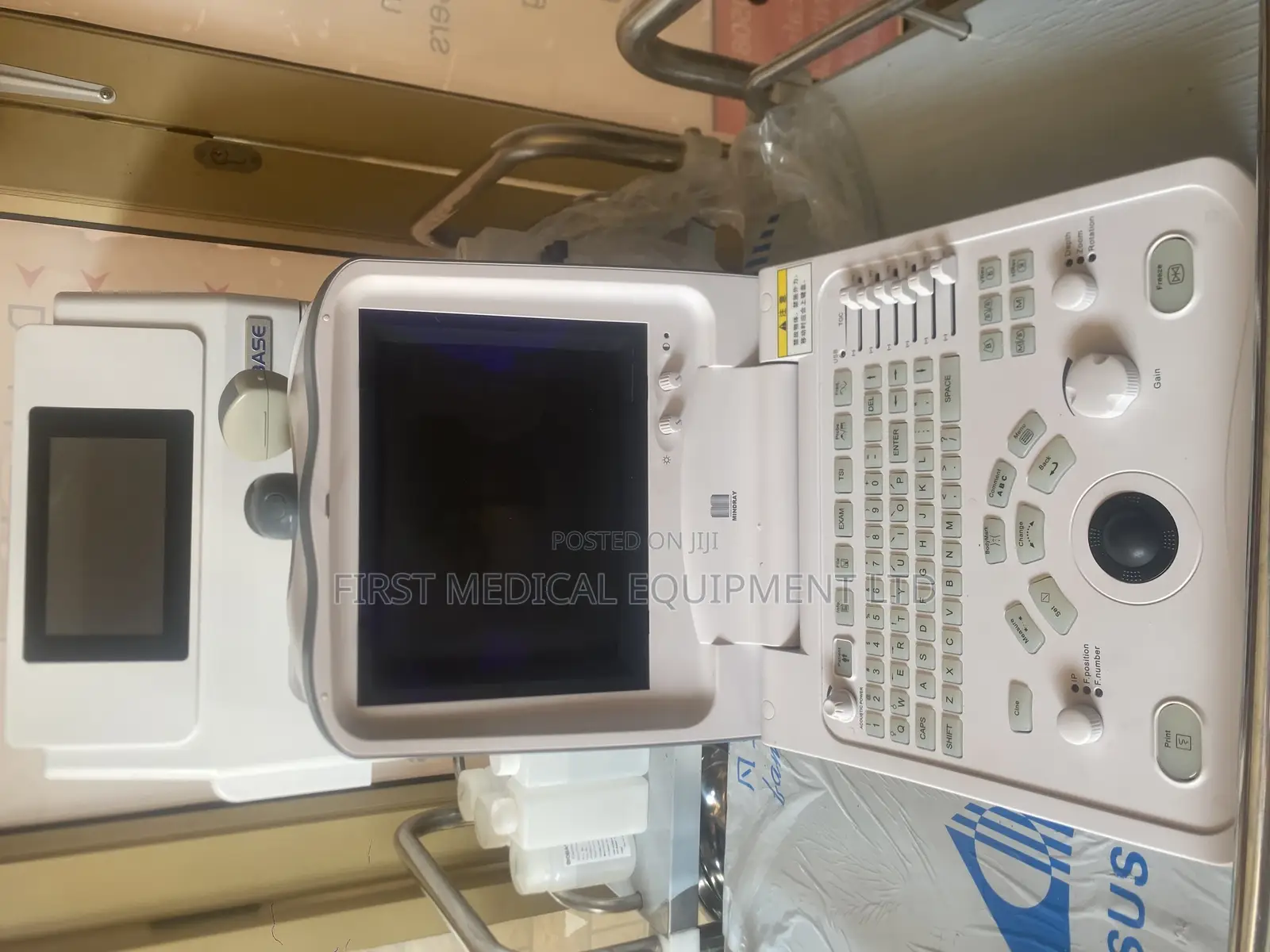 Ultrasound Scan Dp6600