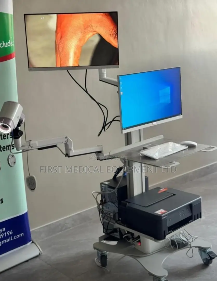 Colposcope