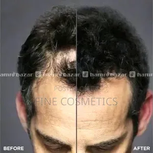 Dexe Hair Building Fibers, Fill Hair Loss, Baldness/Thinning