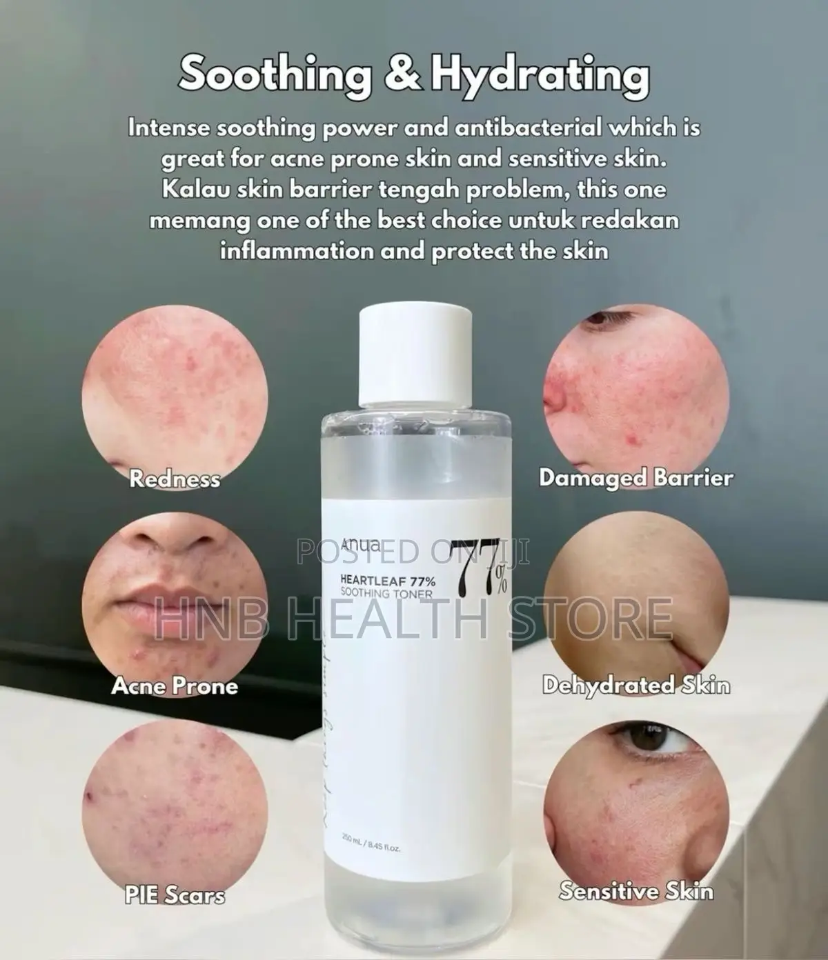 Skin Soothing Tona Anua.