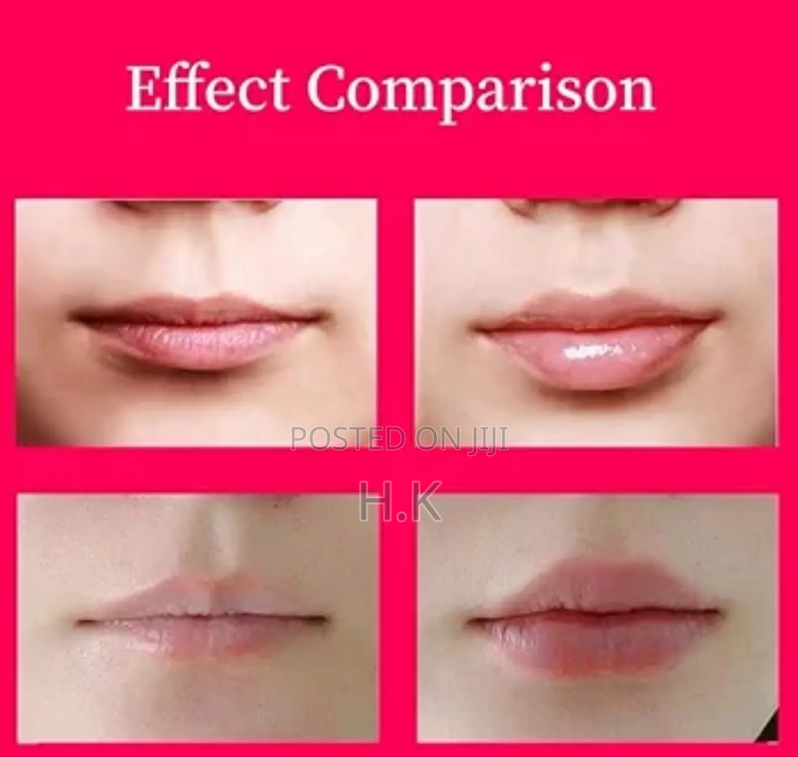 Lip Plumper Tool