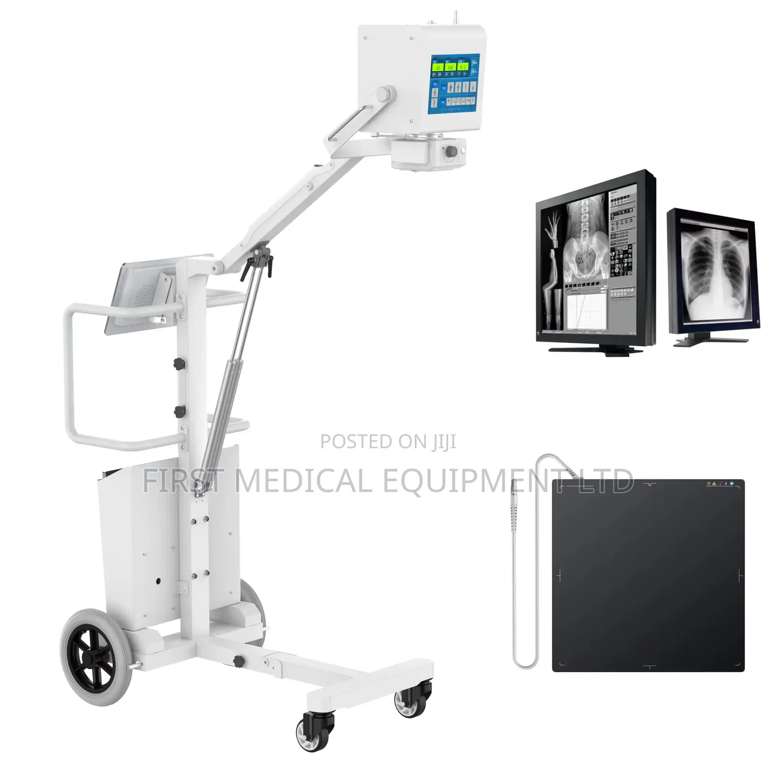 Fully Digital Portable Xray
