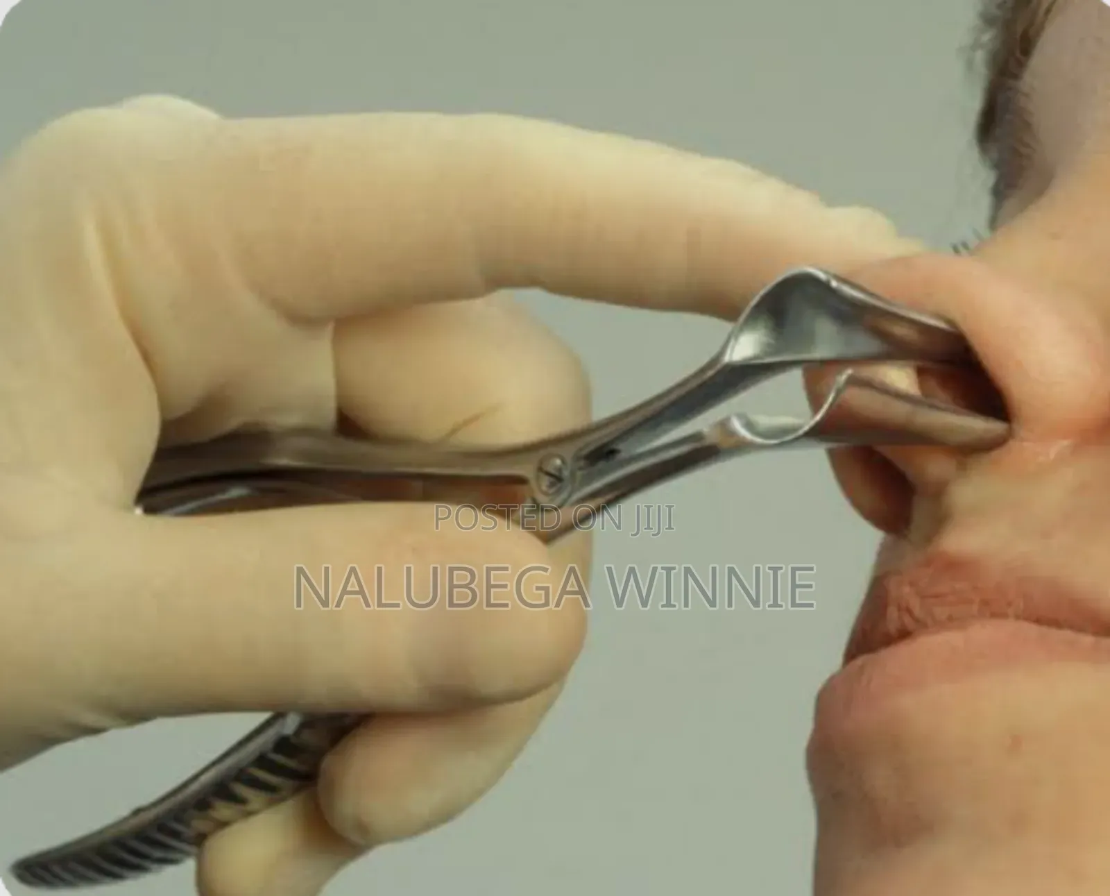Nasal Speculum