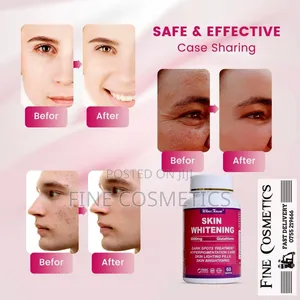 Skin Whitening Tablets Glutathione Toning Darkspots Brightening Pills