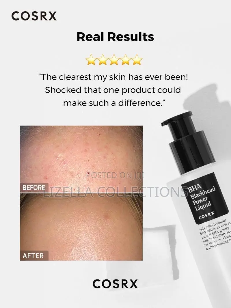 Cosrx Bha Blackhead Power Liquid, 100ml (No Blackheads, Acne Prone