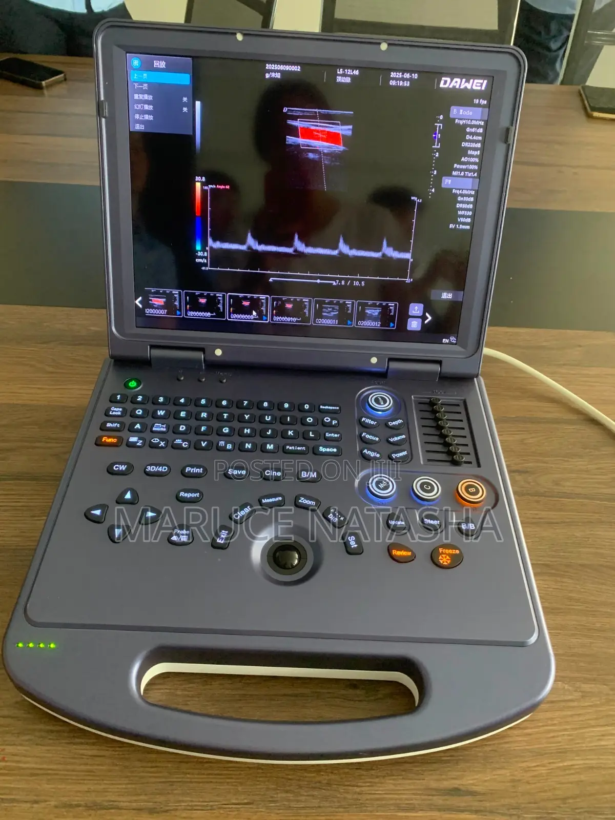 Brand New Portable High End Dawei Ultrasound Scan Machine