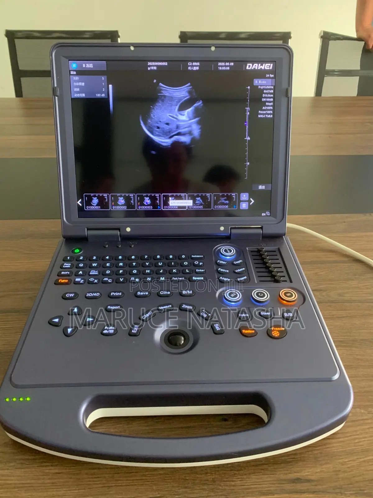 Brand New Portable High End Dawei Ultrasound Scan Machine