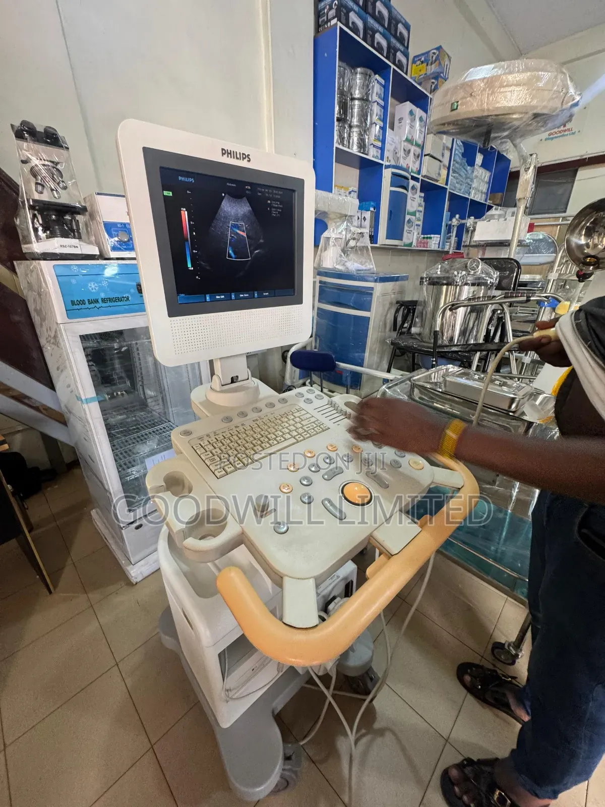 Phillips Hd3 Ultrasound Scan