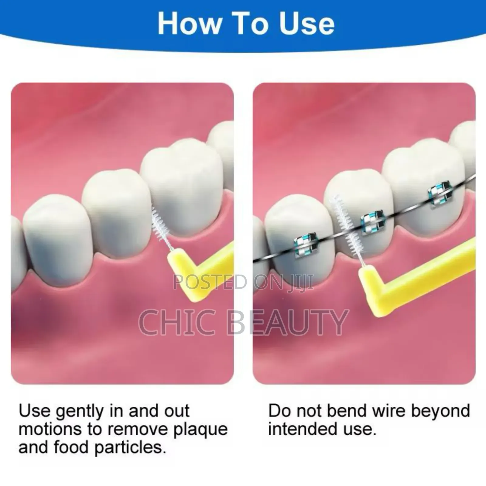 Interdental Brushes for Braces Clean Where Your Brush Can't Reach 10pc