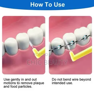 Interdental Brushes for Braces Clean Where Your Brush Can't Reach 10pc