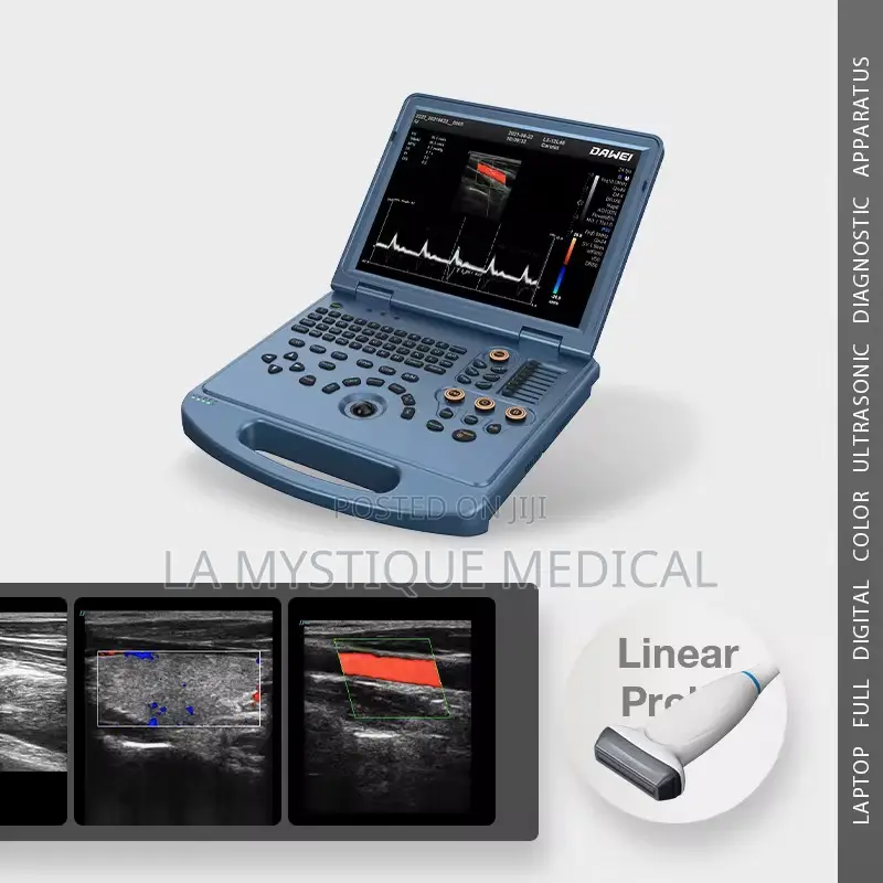 Portable High End Dawei Ultra Sound Scan Machine With a 3d Probe