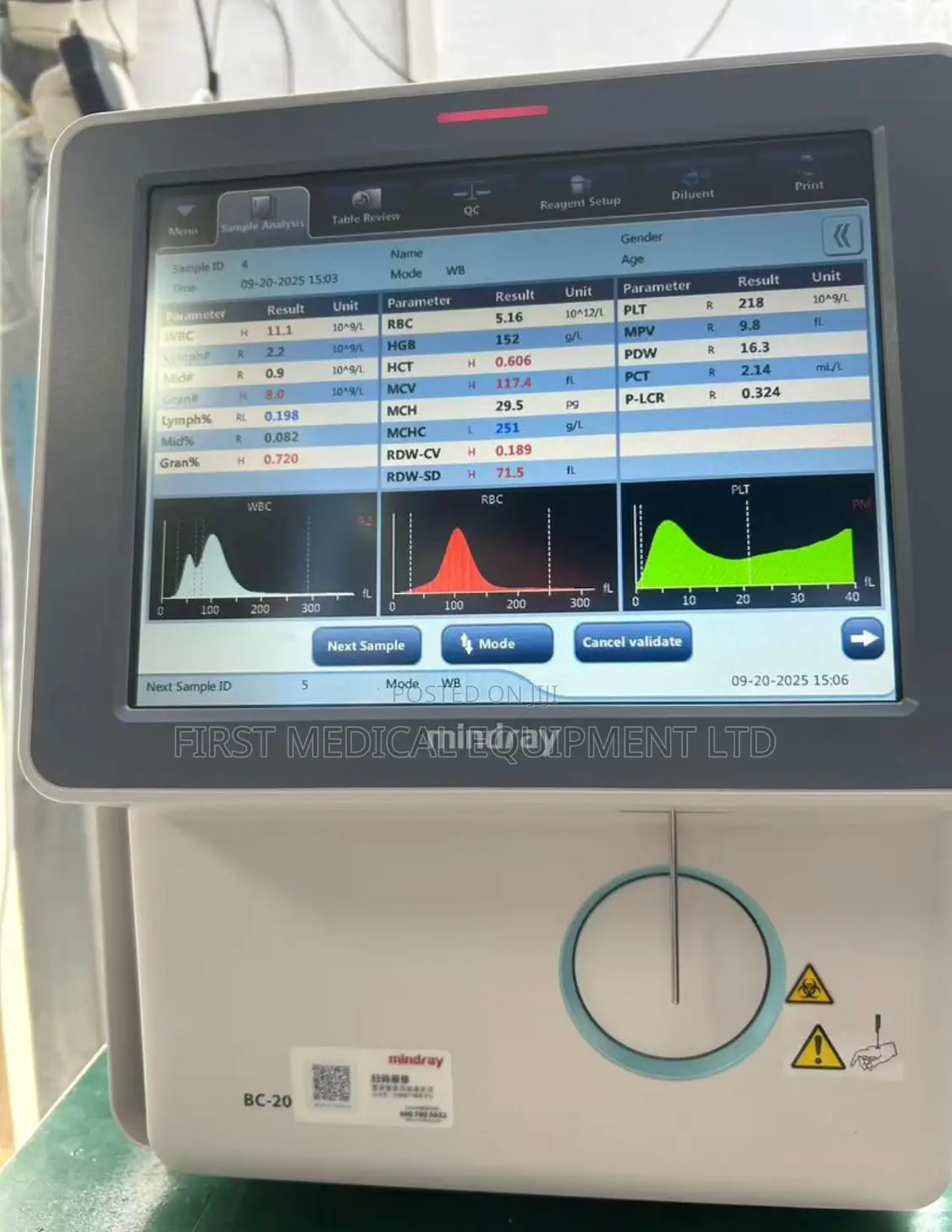 Mindray Bc 20 Hematology Analyser