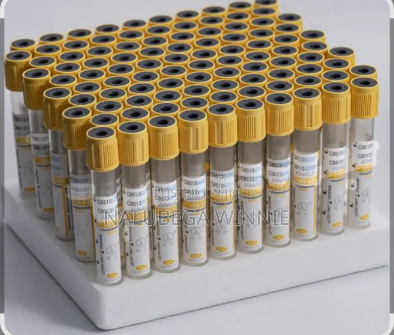 SST Tubes or Gel and Clot Activator Tubes