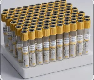 SST Tubes or Gel and Clot Activator Tubes