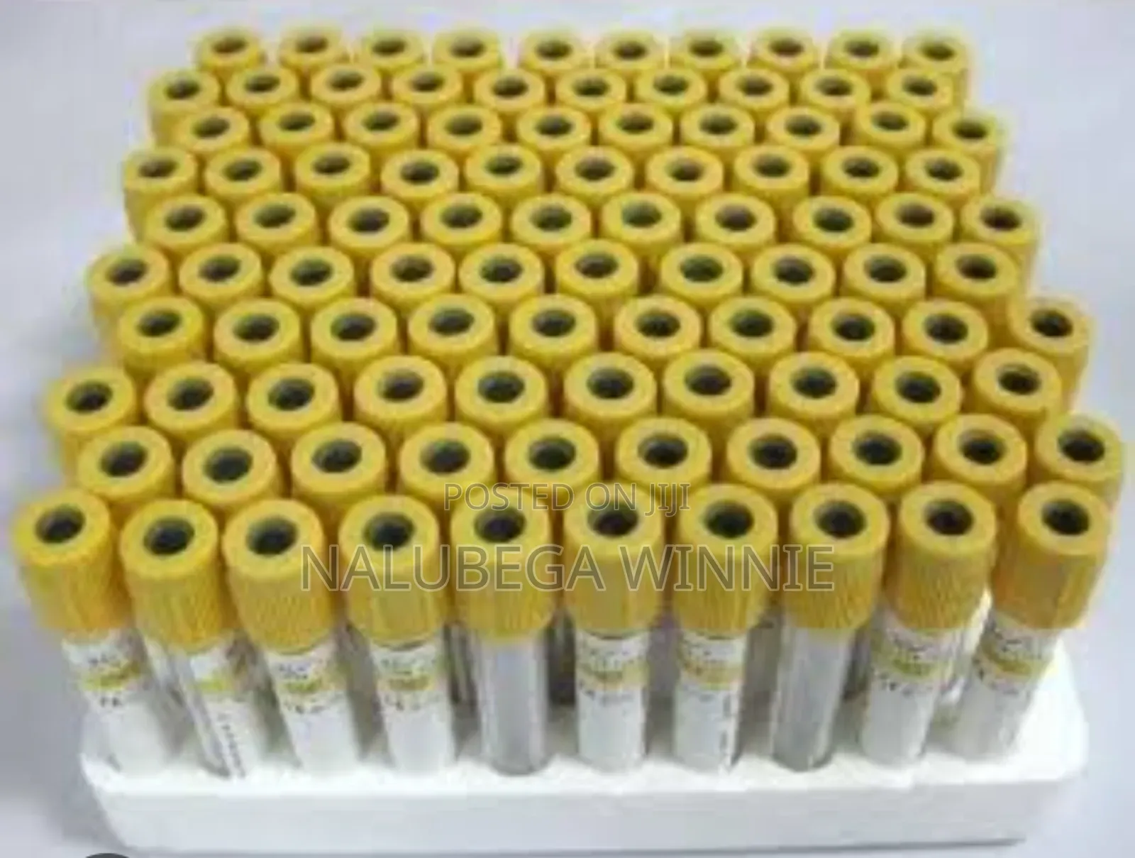 SST Tubes or Gel and Clot Activator Tubes