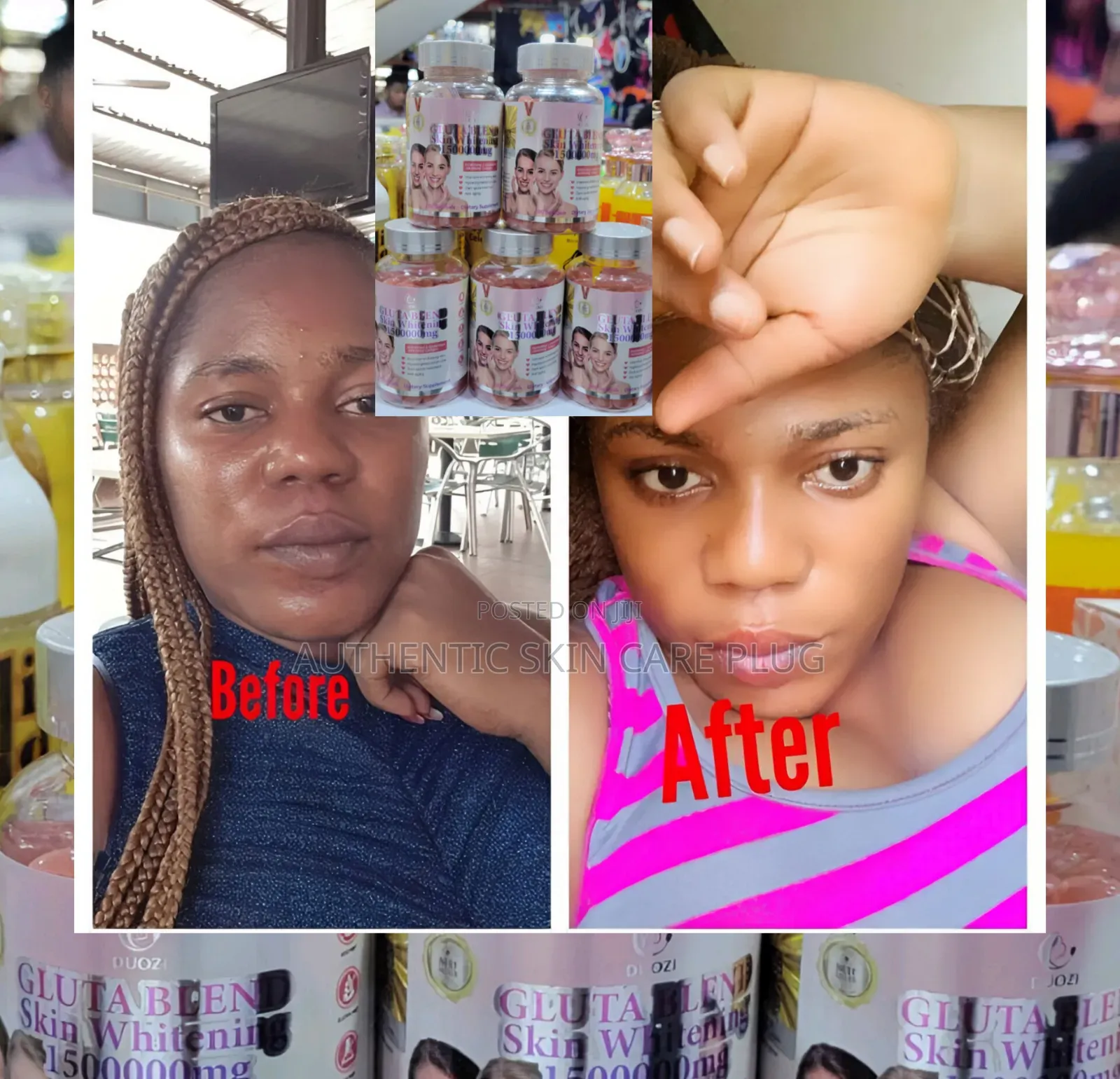 Advanced Gluta Blend Strong Skin Lightening 150000mg Soft Gels 200gels