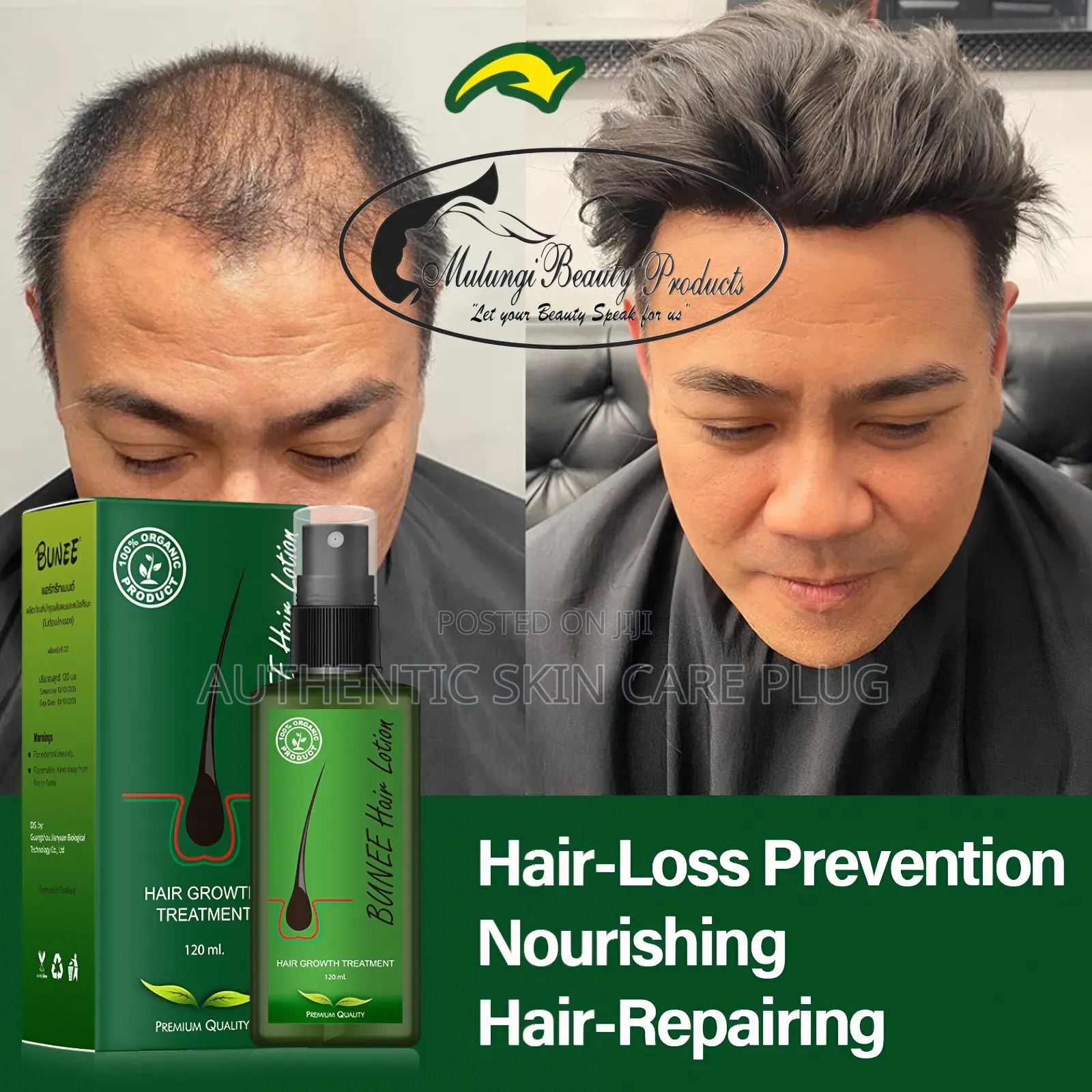 Bunee Hair Growth Treatment 100% Organic Product With Premium Quality.