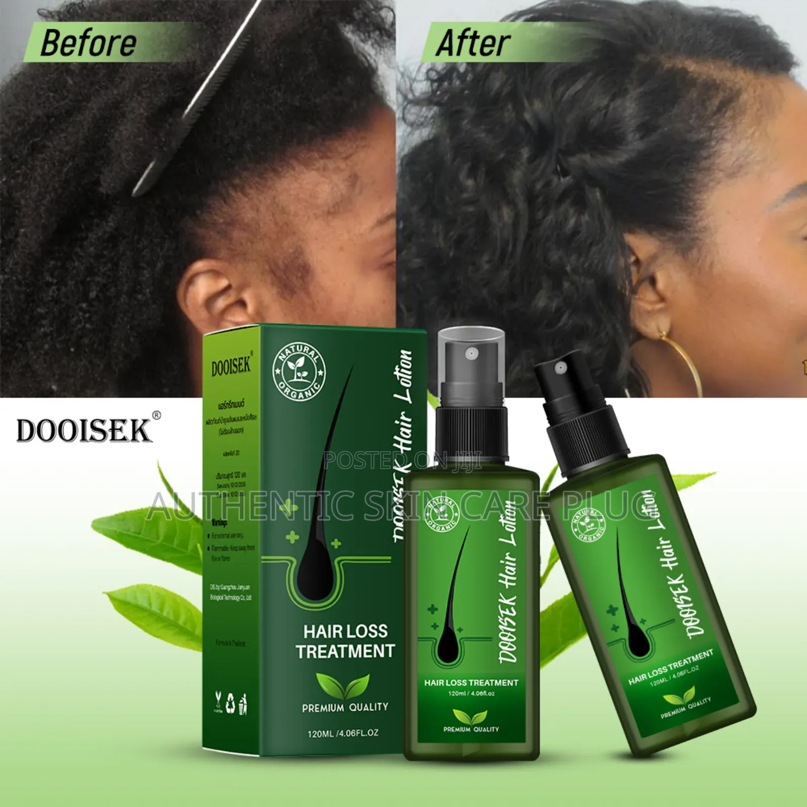 Bunee Hair Growth Treatment 100% Organic Product With Premium Quality.