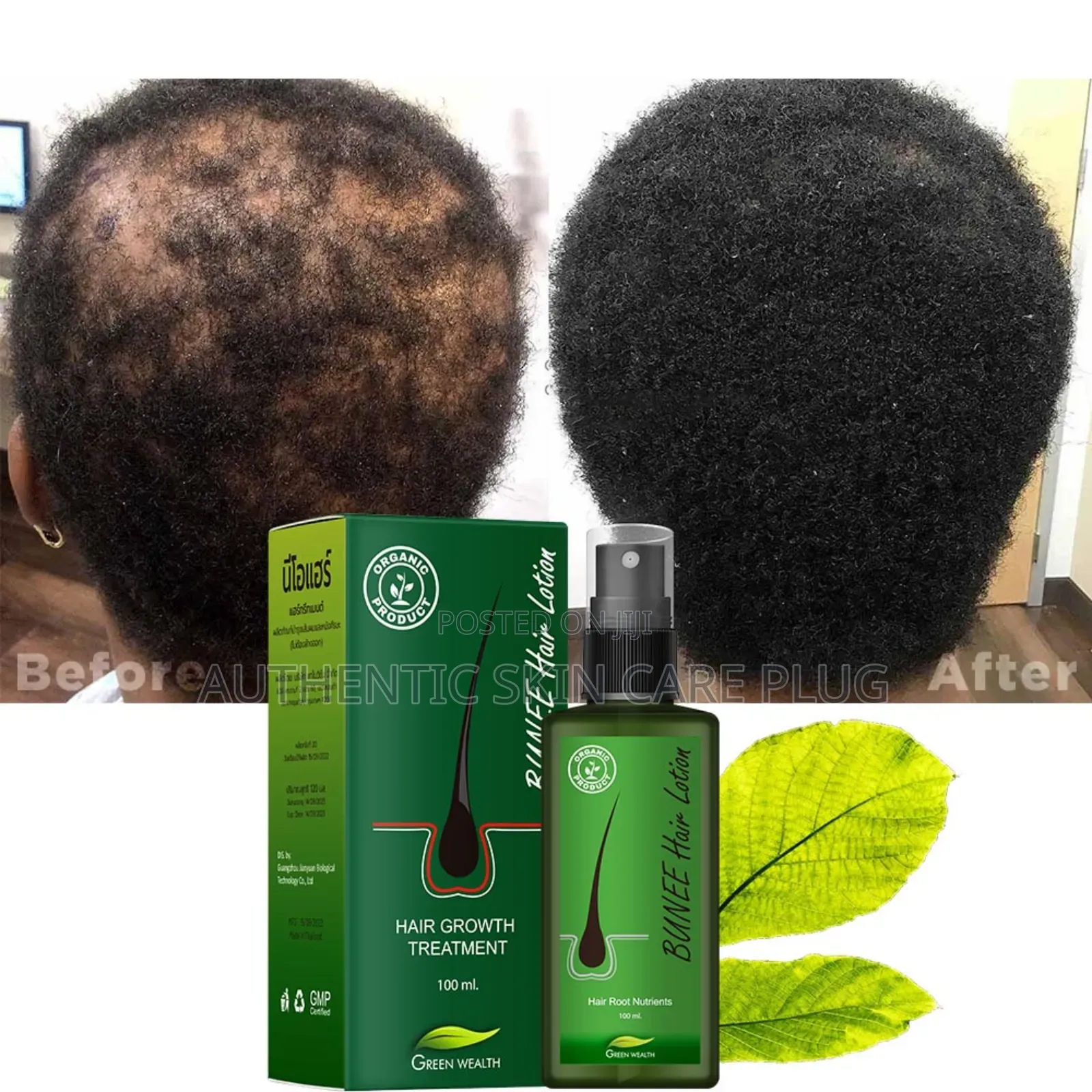 Bunee Hair Growth Treatment 100% Organic Product With Premium Quality.