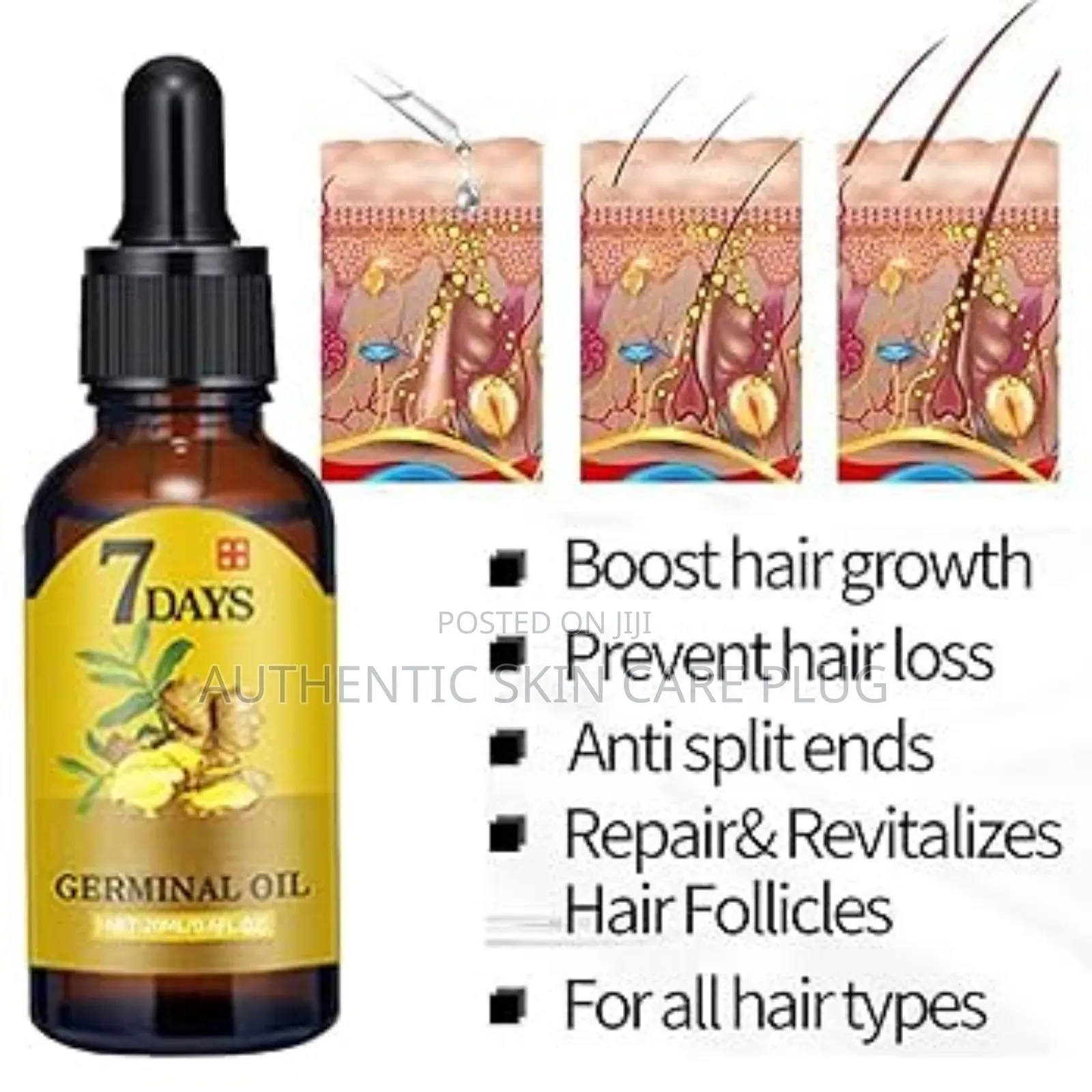 7 Days Fast Ginger Hair Growth Serum Anti-Loss Hair Regrowth