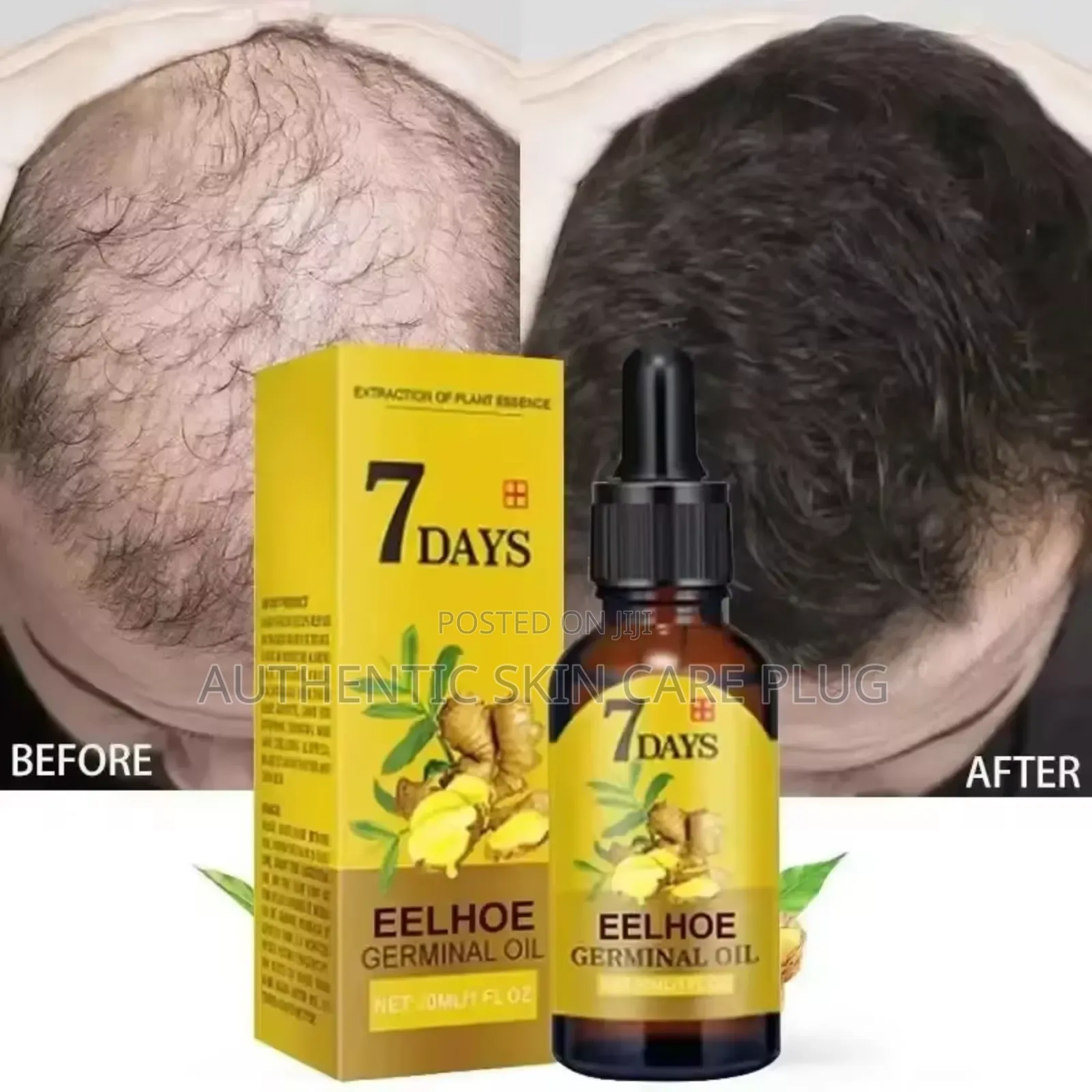 7 Days Fast Ginger Hair Growth Serum Anti-Loss Hair Regrowth