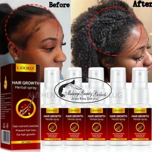 Lidoria Hair Growth Serum Spray Fast Hair Growth Liquid Treatment