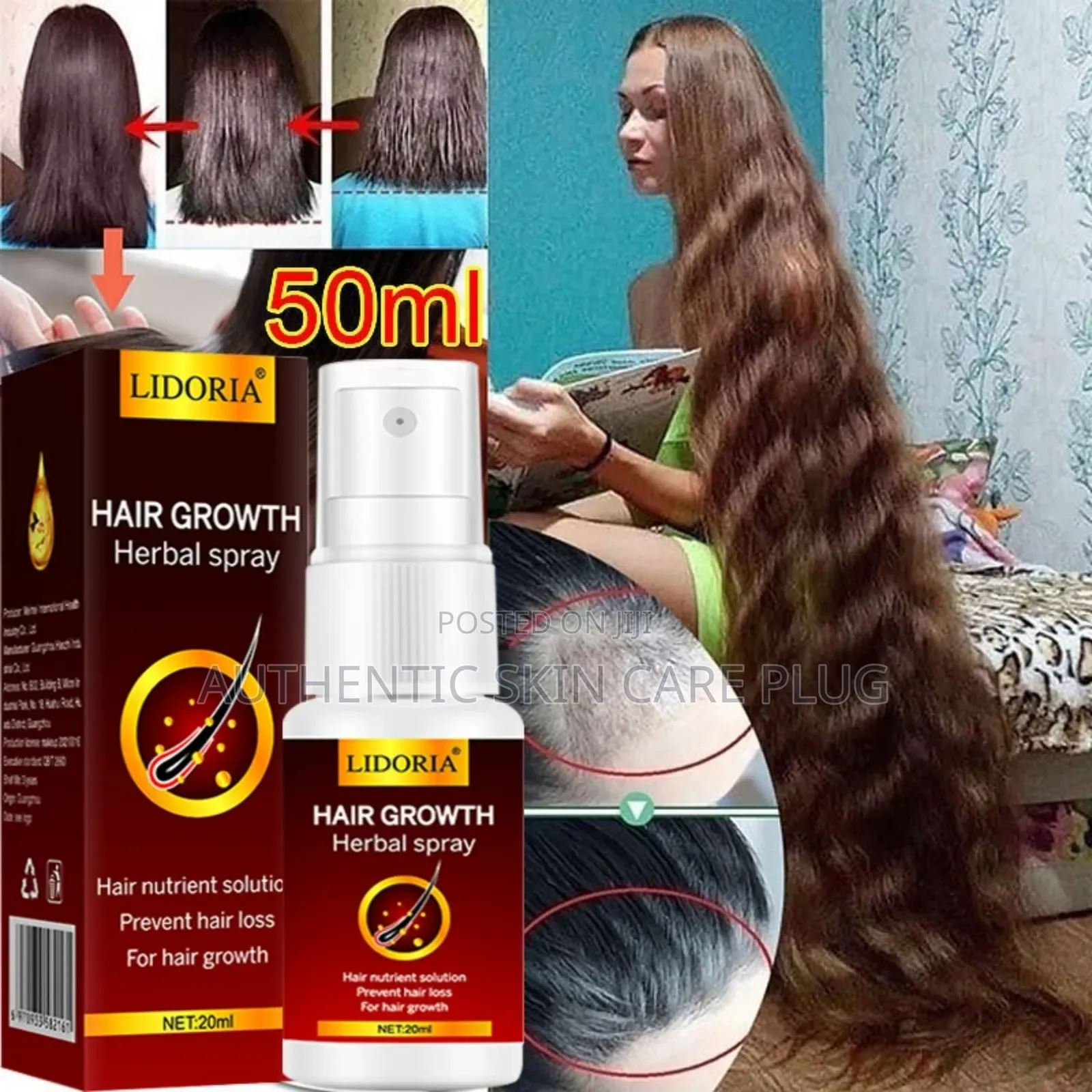 Lidoria Hair Growth Serum Spray Fast Hair Growth Liquid Treatment