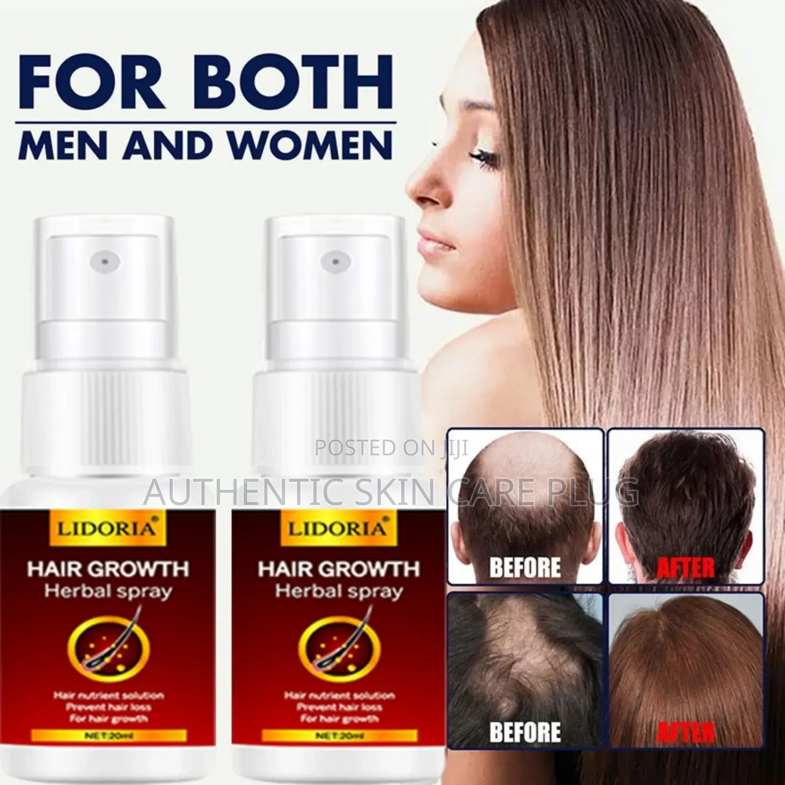 Lidoria Hair Growth Serum Spray Fast Hair Growth Liquid Treatment