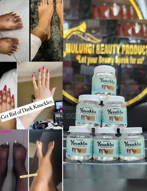 7days Knuckles Removal Gel, Hands Feet ,Knee,Etc