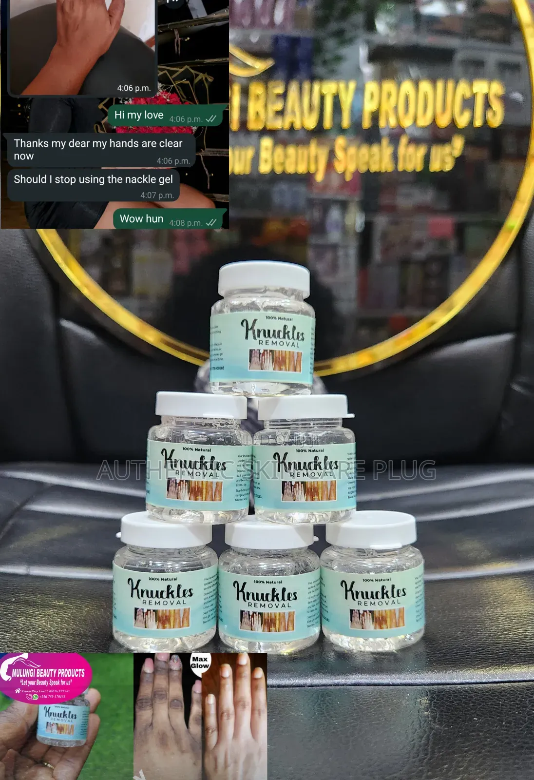 7days Knuckles Removal Gel, Hands Feet ,Knee,Etc