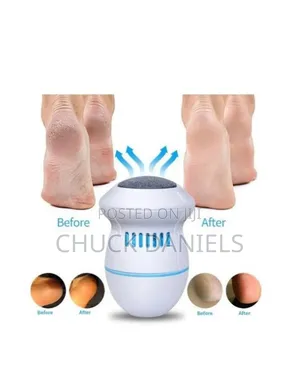 Callus Remover for Pedicure