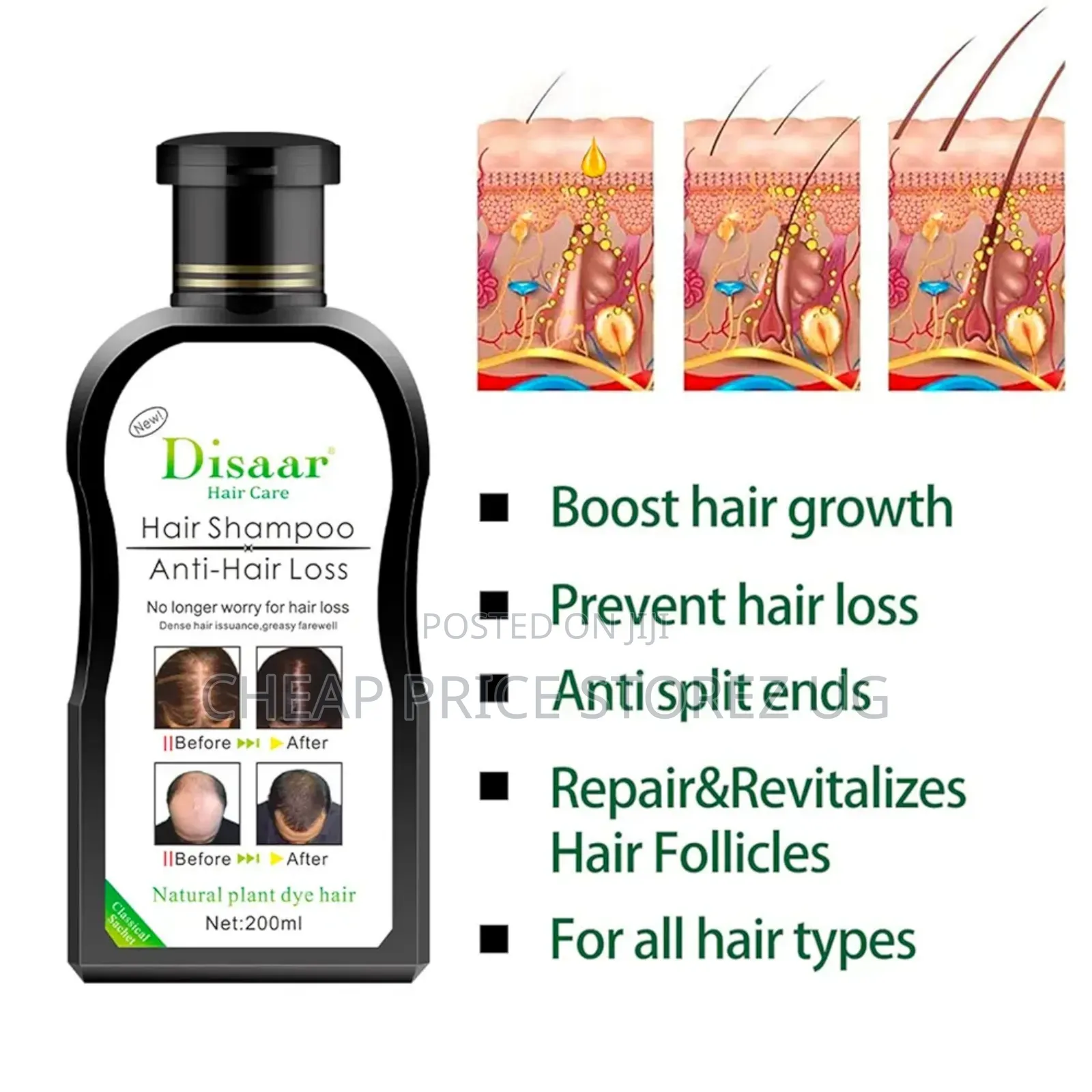 Anti-Hair Loss Shampoo Growth Serum Hair Loss Herbal Treatment 200ml