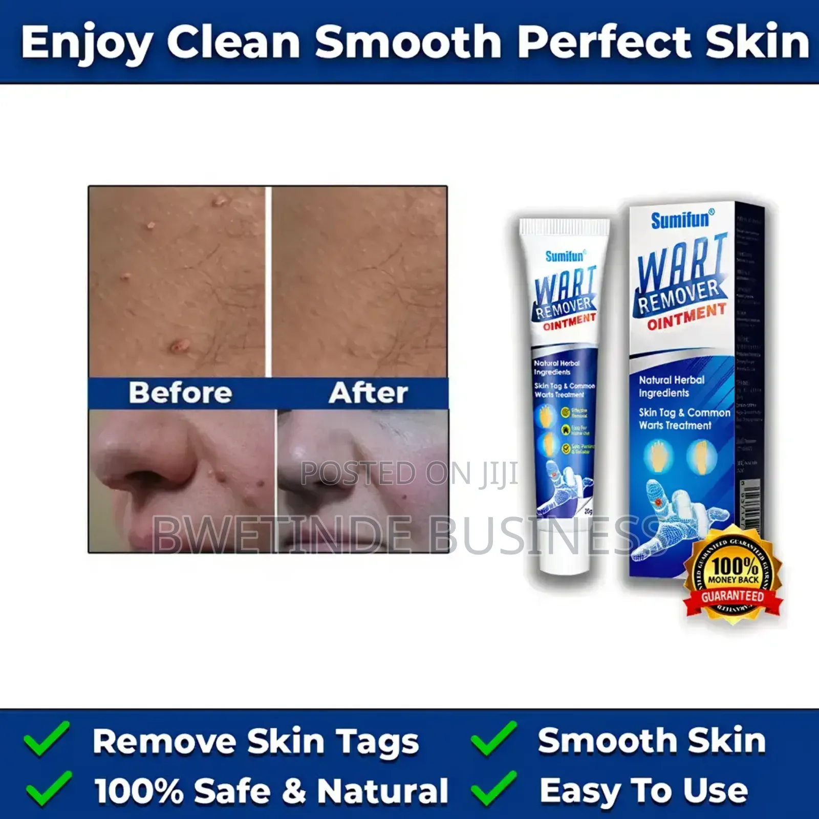 Wart Removal Cream