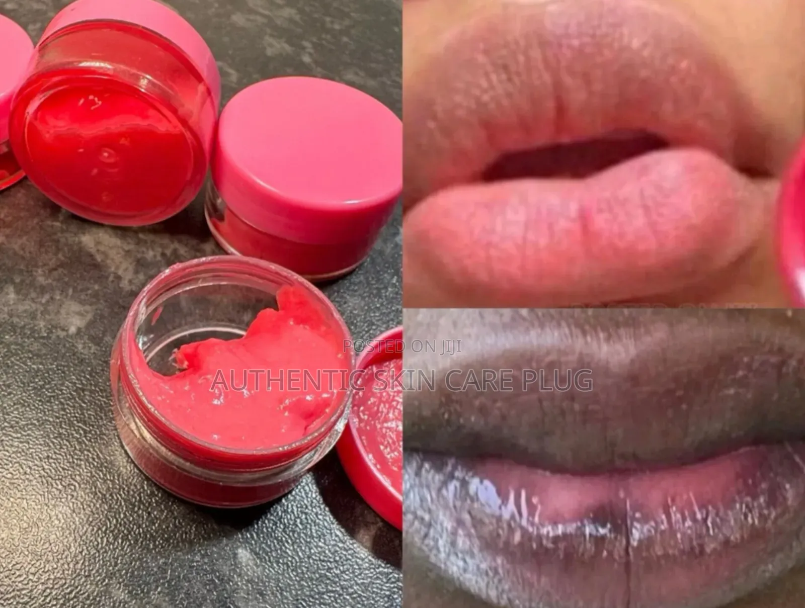 Original Pink Lips Cream for Both Men and Women 10g 3days Results